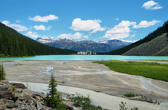 Jezero Louise v N.P. Banff, Aljaška, USA